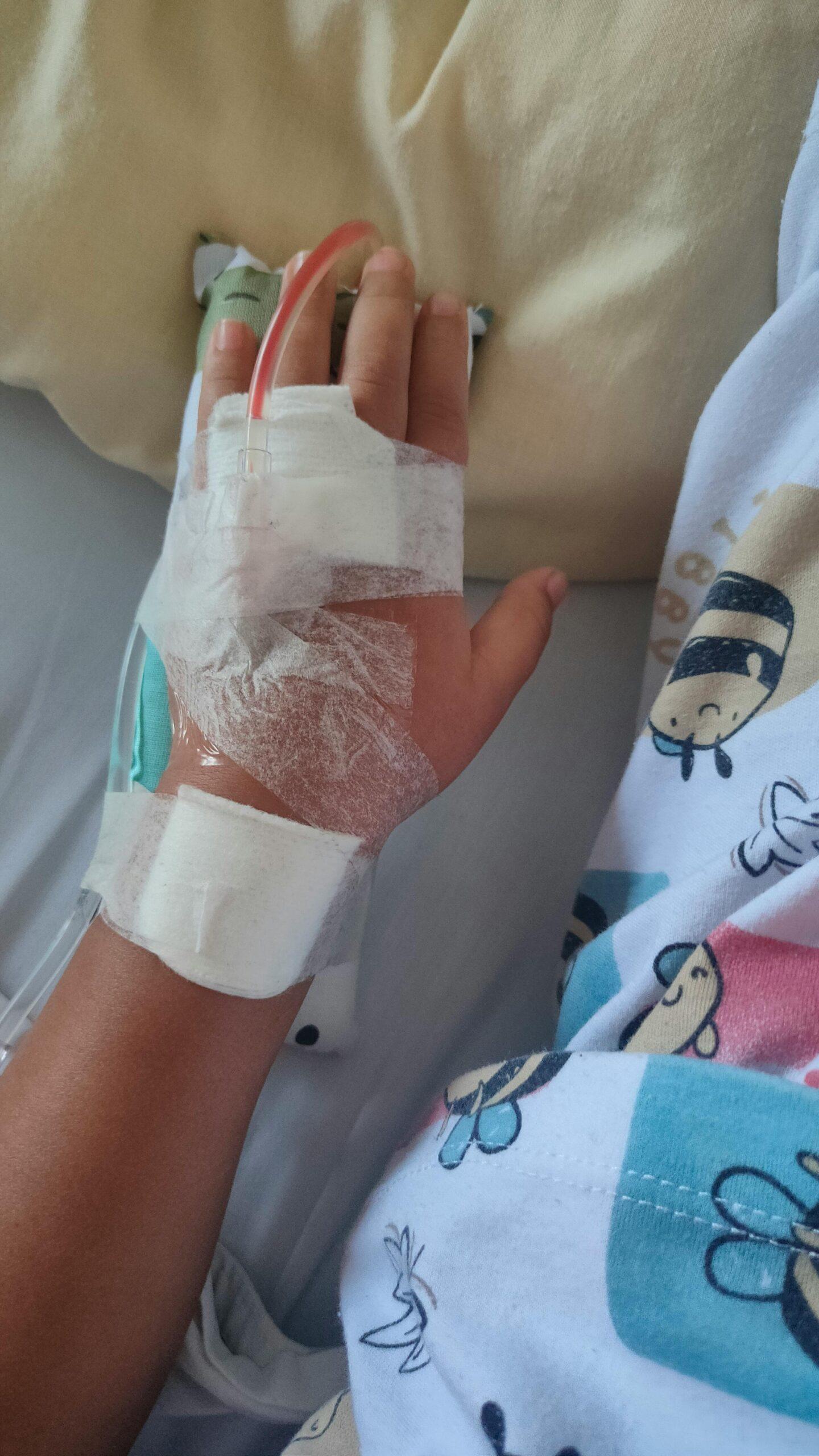 Burn Injury