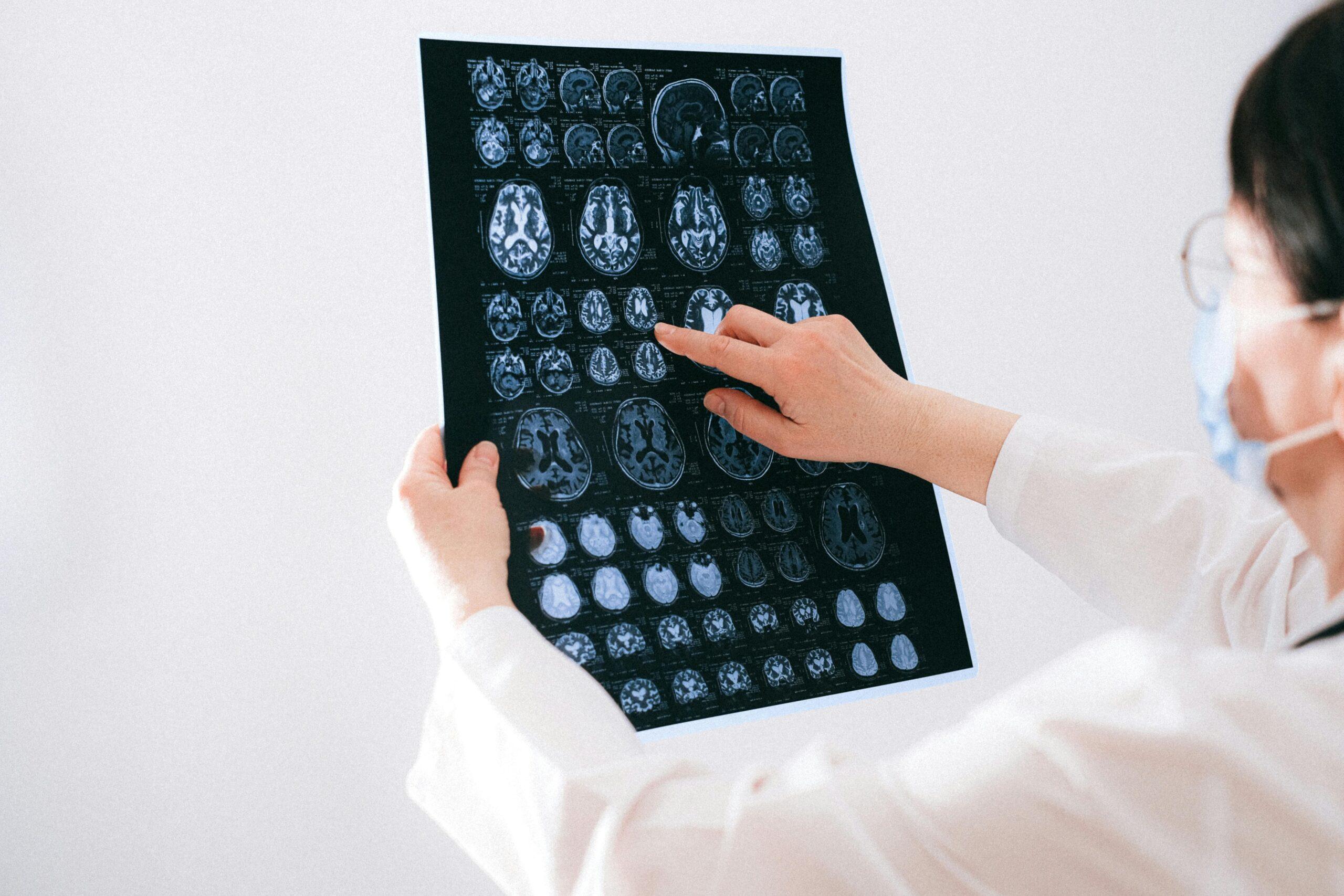 Abogado de lesiones cerebrales de Columbus