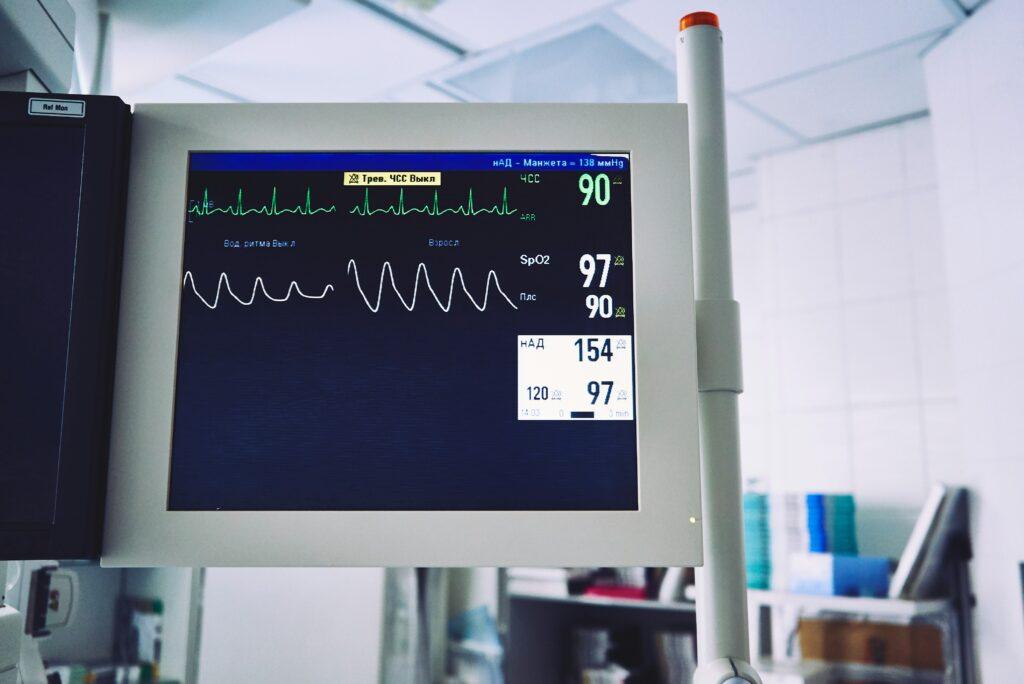 Close-up of a hospital heart monitor showing vital signs such as heart rate, oxygen saturation, and blood pressure in a brightly lit medical room.